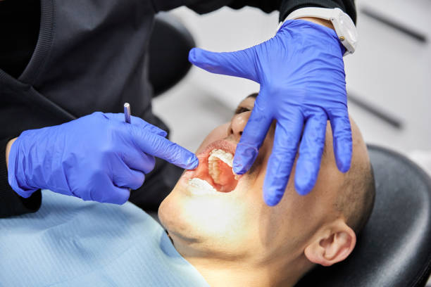 Best Emergency Treatment for Dental Infections or Abscesses in Jeffersonville, IN